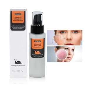 Authentic Snail Serum with 96% Mucin, Collagen, and Hyaluronic Acid for Moisturizing Face Pores and skin Care